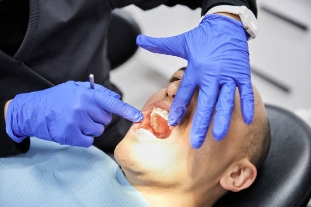 Best Emergency Denture Repair in Redfield, SD